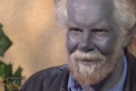 Colloidal Silver Singing the Blues