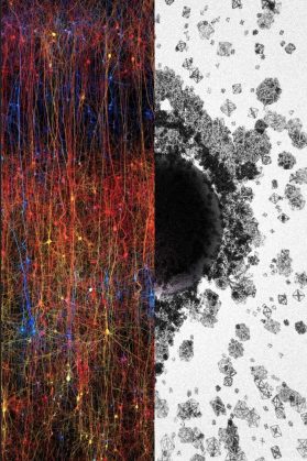 Εγκέφαλος ο 11διάστατος